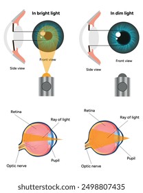 Pupil size in different lighting, Dilated pupil
and Undilated pupil  with Eye anatomy ophthalmology diagram 