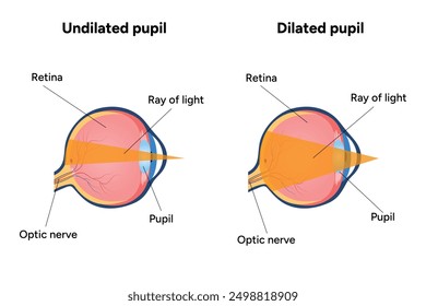 Pupil size in different lighting Dilated pupil and Undilated pupil with Eye anatomy ophthalmology