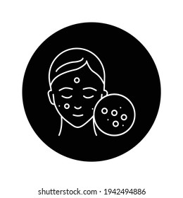 Pustule black glyph icon. Sign for web page, mobile app, button, logo