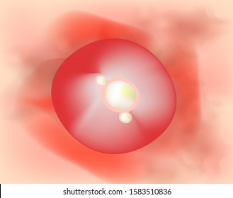 Pustules on the skin. Cystic acne. Pimples on the skin background. Furuncle. Acne on the skin texture. Infographics. Vector illustration.