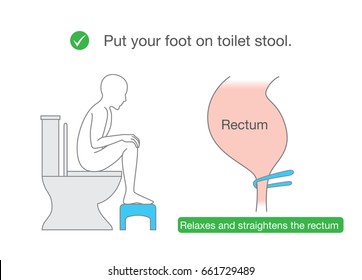 Put your foot on small benches while sitting on toilet for relax muscle and straightens the rectum. Illustration about Correct posture for healthy.