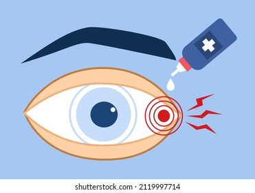 Poner colirios en el ojo seco o en el tratamiento ocular doloroso en diseño plano. Aplicación diaria de lentes de contacto. 