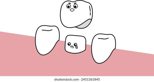 putting on Dental crown, dental treatment - flat illustration 