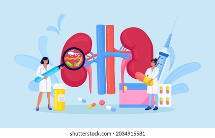 Pyelonephritis. Tiny Doctors Nephrologist Diagnostik und Untersuchung Patienten mit Nierenerkrankung, Urin-Test, Diagnostik. Ärzte überprüfen die Gesundheit der Nieren. Nephrologie innere Organe Behandlung