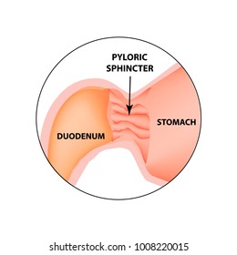 Pyloric sphincter of the stomach duodenum. Pylorus. Infographics. Vector image on isolated background