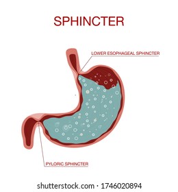 Pyloric Sphincter Of The Stomach Duodenum. Pylorus. Lower Esophageal Sphincter Doesn’t Relax.