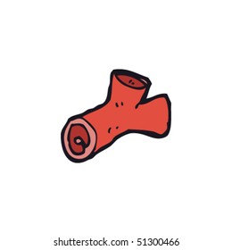 dibujo peculiar de una arteria humana