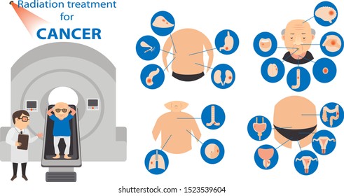 Radiation Therapy ForTreatment Cancer Infographic. Vector Illustration