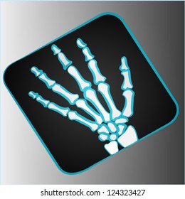 Radiography with black background.
