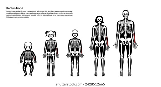 Radius bone anatomy. Forearm in human skeletal system diagram. Skeleton in male, female, baby, child and adult silhouettes. Bones, cartilage and joints in body xray medical poster vector illustration