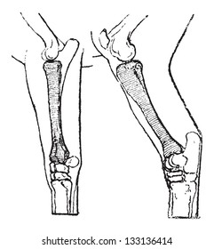 Radius (left, found in the forelimbs) and Tibia (right, found in the hindlimbs) of a Horse, vintage engraved illustration. Dictionary of Words and Things - Larive and Fleury - 1895