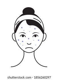 Rash Face Icon Vector. Upset Girl With Pimple, Spot On Problem Skin. Info-graphic Of Acne In Outline Style Illustration Isolated On White Background.