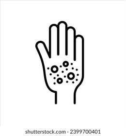 Rash hand icon. chickenpox hand plam with redness acne pimple rash burn due to epidermis or urticaria allergic symptoms causes irritation and itching skin symbol logo vector. psoriasis itchy rash  