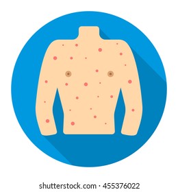 Rash icon cartoon. Single sick icon from the big ill, disease collection.