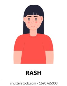 Rash Icon Vector. Unhappy Girl With Rash And Acne On Her Face. Woman Is Infected By Rubella, Measles. Allergy, Eczema Illustration. Skin Disease Concept.