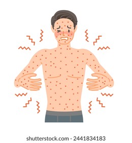 Rash: A man suffers from itching and pain all over his body due to hives.