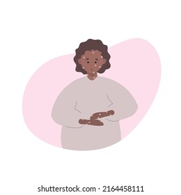 Rash on African female hands and face. Monkey pox symptoms. World epidemic outbreak. Disease spread awareness. Vector illustration in flat style.