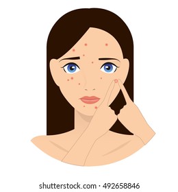 Rash on the face illustration. Pimples on the face. Dermatology illustration. Acne illustration. Allergy. The girl with the rash on the face. Girl with pimples on her face illustration.