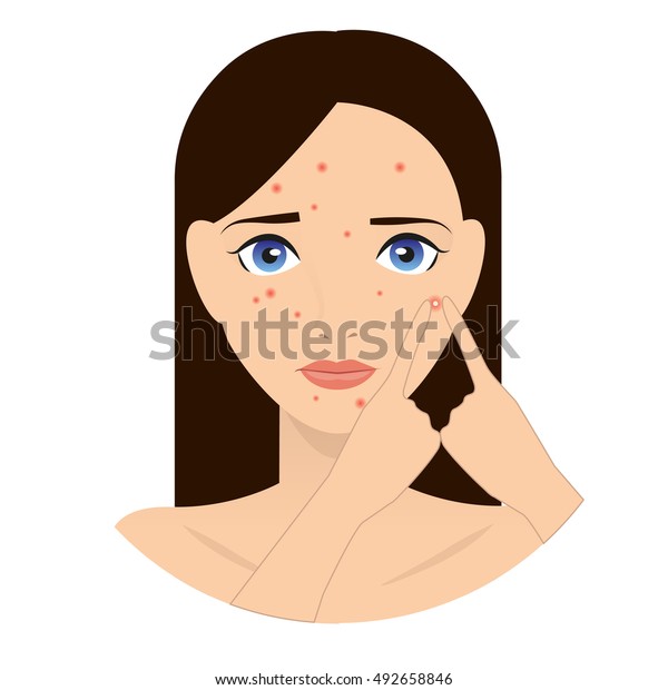 顔に発疹ができた 顔ににきび 皮膚科のイラスト にきびのイラスト アレルギー 顔に発疹ができた女の子 顔ににきびを持つ女の子のイラスト のベクター画像素材 ロイヤリティフリー 492658846