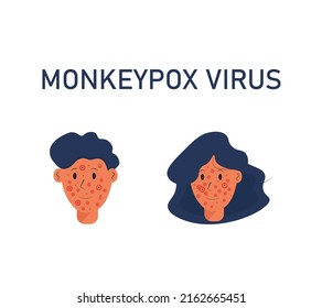 una erupción en la cara de una persona por viruela. Virus de la monovena, enfermedad viral zoonótica que puede infectar primates humanos no humanos. Viruela de mono. Ilustración del vector