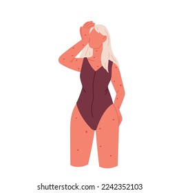 Rash on the skin. Autoimmune disease, chickenpox, atopic dermatitis. A woman has a rash. Flat vector illustration