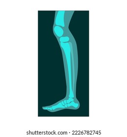 Ray of human leg vector illustration. Bones of skeleton, roentgen, radiography isolated on white background. Anatomy, medicine, health concept