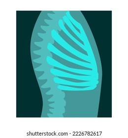 Ray of human rib cage vector illustration. Bones of skeleton, roentgen, radiography isolated on white background. Anatomy, medicine, health concept