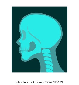 Rayo de la ilustración del vector de la vista lateral del cráneo humano. Huesos de esqueleto, roentgen, radiografía aislados en fondo blanco. Anatomía, medicina, concepto de salud