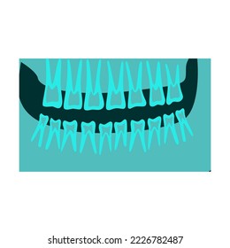 Rayo de mandíbula superior e inferior humana con ilustración vectorial de dientes. Huesos de esqueleto, roentgen, radiografía aislados en fondo blanco. Anatomía, medicina, concepto de salud