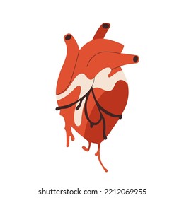 Real Heart, Realistic Internal Human Organ With Blood, Aorta, Artery. Creepy Cardiovascular Anatomy. Anatomical Flat Graphic Vector Illustration Isolated On White Background