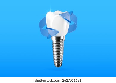 Realistic 3D dental implantation composition with blue arrows. Dental activity illustration