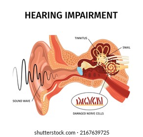 Realistic anatomy ear tinnitus composition with sound internal organs view with pointers and editable text captions vector illustration