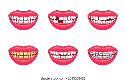 Realistic Detailed 3d Dental Problems Set Different Types Health Care and Dentistry Hygiene Concept. Vector illustration of Treatment