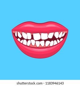 Realistic Detailed 3d Wry Dental Problem on a Blue Health Care and Dentistry Hygiene Concept. Vector illustration of Treatment