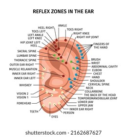 Composición de zonas reflexivas de oreja realista con diagrama de puntos de acupuntura y subtítulos de texto editables con ilustraciones vectoriales punteros