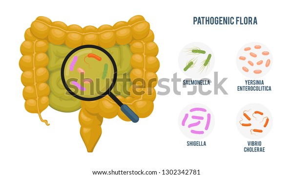 リアルな平らなベクターイラスト 腸 腸内微細叢のインフォグラフィック 白い背景にカートーンイラスト 病原菌叢 サルモネラ菌 エルシニア エンテロコリチカ 菌 シゲラ菌 コレラ菌 のベクター画像素材 ロイヤリティフリー