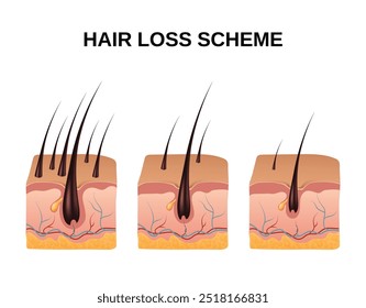 Esquema de composição de transplante de cabelo realista definido