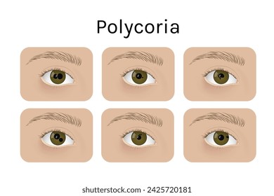 Realistic human eyes with polycoria vector illustration design