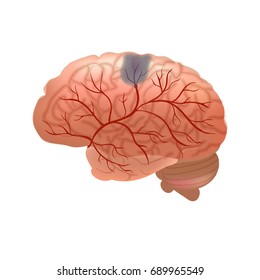Realistic human sick brain isolated on white background.