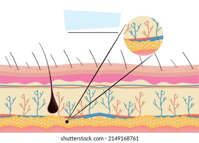 Realistic Human Skin Diagram Design Stock Vector (Royalty Free ...