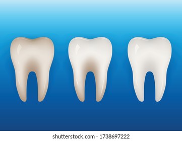 Realistic human tooth model. Graphic vector 