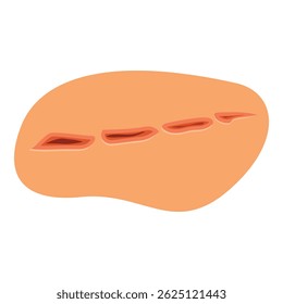 Ilustração realista de um corte profundo da pele mostrando o tecido muscular, ideal para publicações médicas e de saúde