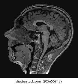 Realistic image sagittal of male head with CT scan, MRI Magnetic resonance imaging layer of head. Isolated on dark background. Vector illustration.