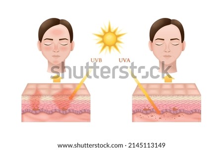 Realistic infographics showing how uvb and uva sun radiation types affect skin with anatomy of its layers and female faces vector illustration