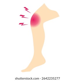 Realistic knee pain illustration isolated on white background. Vector for medical and health care use.