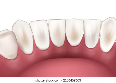 La parte inferior de los dientes es realista. 3 d de la mandíbula inferior. Anatomía dental. Diente médicamente preciso. Concepto médico ortodoncista. Vector 