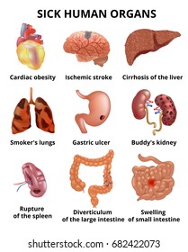 Realistic sick human organs set anatomy with text