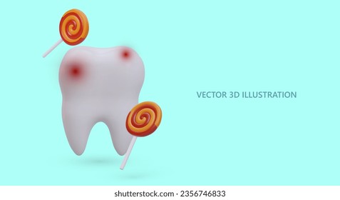 Realistic sick tooth. Tooth enamel damaged by candy. Caries. Treatment, sealing, prevention. Warning to patients. Color vector poster, concept for dental clinic