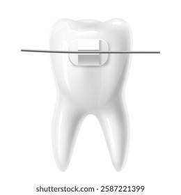 Realistic tooth with braces. White 3d isolated teeth, bite correction in stomatology clinic. Orthodontist treatment brackets isolated. Medicine healthcare procedure. Vector dentistry concept