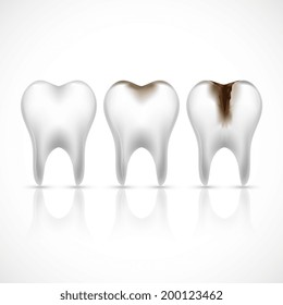 Realistic white and caries broken teeth set vector illustration